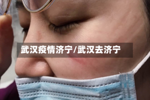 武汉疫情济宁/武汉去济宁