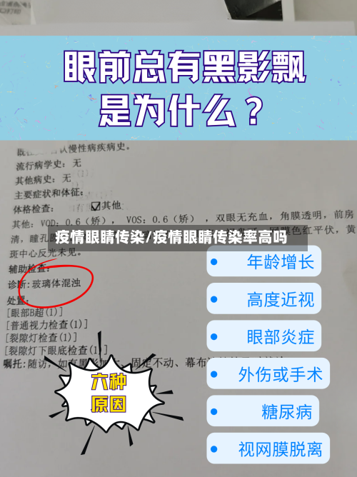 疫情眼睛传染/疫情眼睛传染率高吗-第1张图片