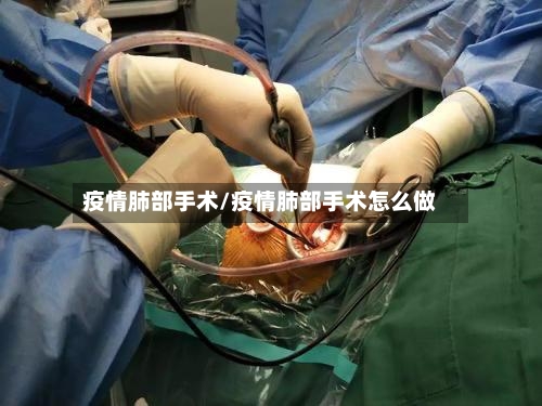 疫情肺部手术/疫情肺部手术怎么做-第1张图片