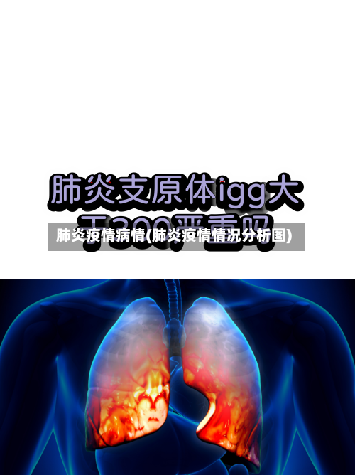 肺炎疫情病情(肺炎疫情情况分析图)-第2张图片